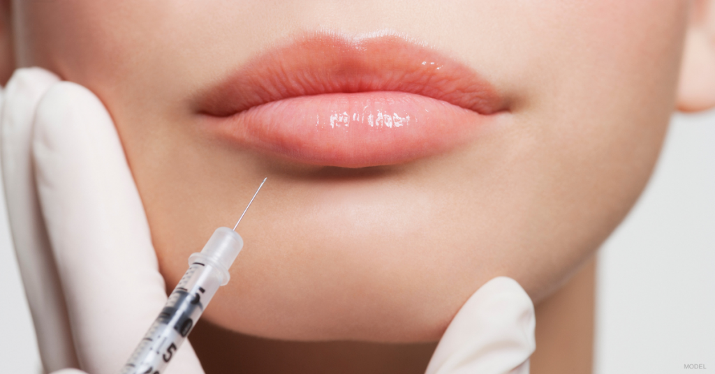 Needle used for dermal lip fillers
